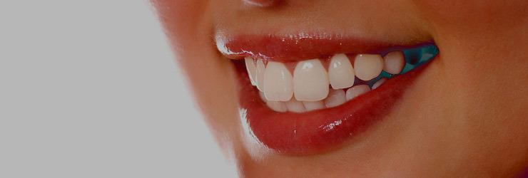 smile 3| JK Dental